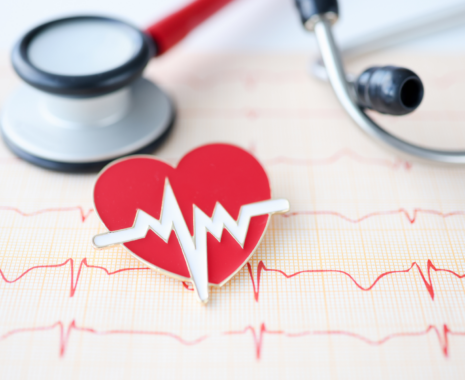 February 2023 – Heart Disease Prevention & How to Spot a Stroke Workshop