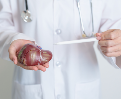 July 2024 – Hepatitis B Workshop